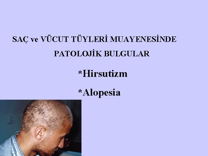 SAÇ ve VÜCUT TÜYLERİ MUAYENESİNDE PATOLOJİK BULGULAR *Hirsutizm *Alopesia 