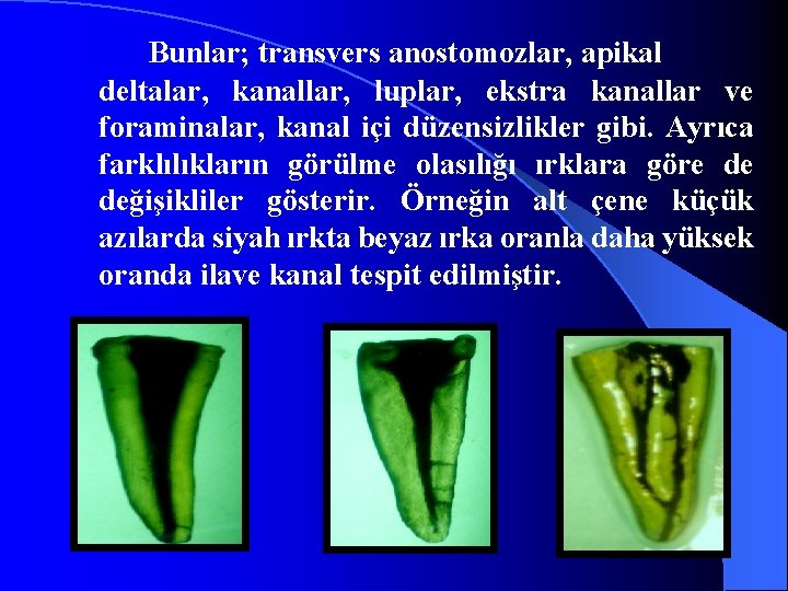 Bunlar; transvers anostomozlar, apikal deltalar, kanallar, luplar, ekstra kanallar ve foraminalar, kanal içi düzensizlikler