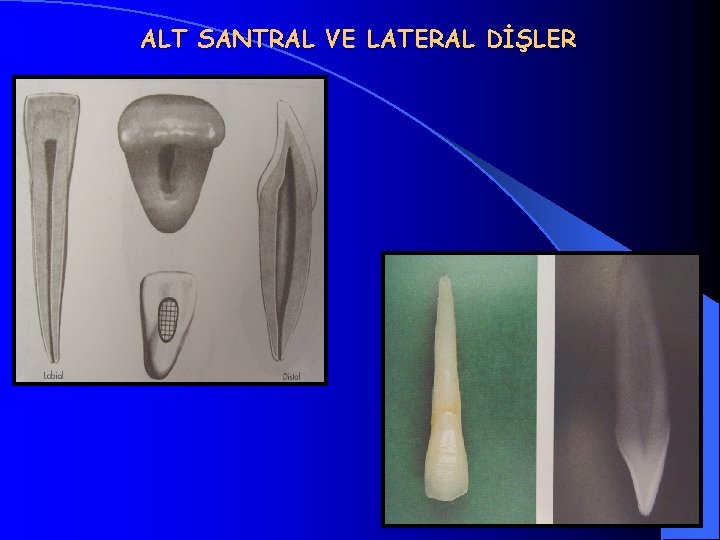 ALT SANTRAL VE LATERAL DİŞLER 