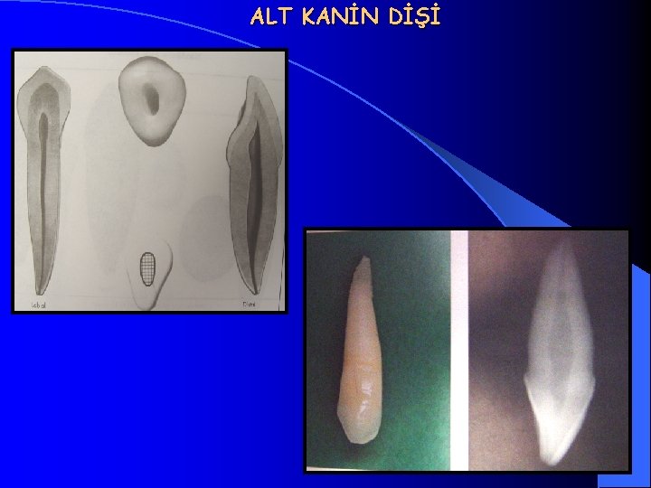 ALT KANİN DİŞİ 