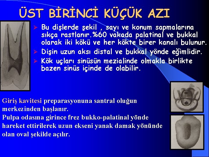 ÜST BİRİNCİ KÜÇÜK AZI Bu dişlerde şekil , sayı ve konum sapmalarına sıkça rastlanır.