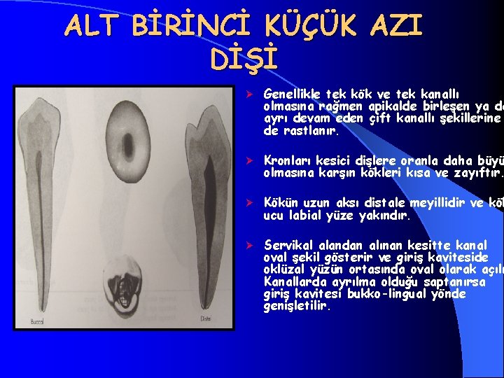 ALT BİRİNCİ KÜÇÜK AZI DİŞİ Ø Genellikle tek kök ve tek kanallı olmasına rağmen