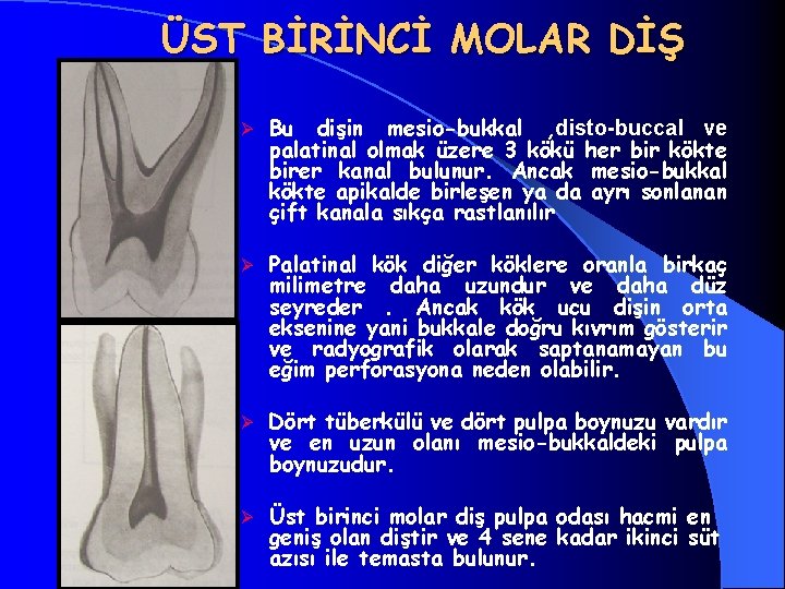 ÜST BİRİNCİ MOLAR DİŞ Ø Bu dişin mesio-bukkal , disto-buccal ve palatinal olmak üzere