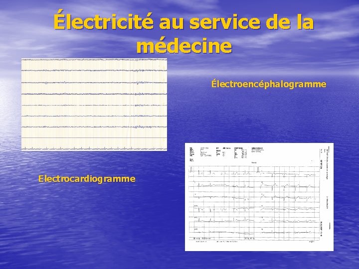 Électricité au service de la médecine Électroencéphalogramme Electrocardiogramme 