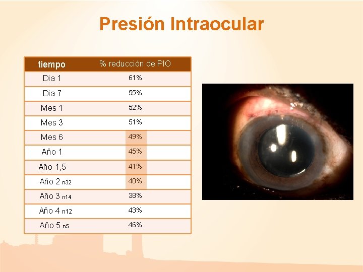 Presión Intraocular tiempo % reducción de PIO Dia 1 61% Dia 7 55% Mes Presión Intraocular tiempo % reducción de PIO Dia 1 61% Dia 7 55% Mes