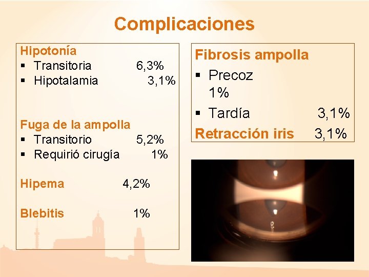 Complicaciones Hipotonía § Transitoria § Hipotalamia 6, 3% 3, 1% Fuga de la ampolla Complicaciones Hipotonía § Transitoria § Hipotalamia 6, 3% 3, 1% Fuga de la ampolla