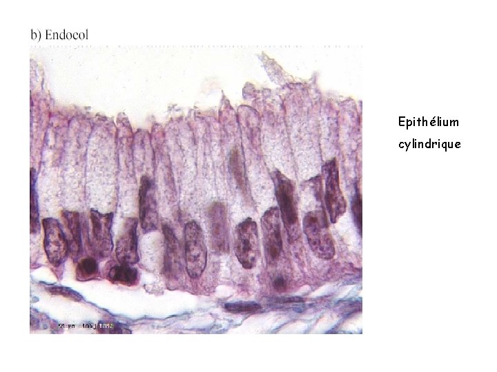 Epithélium cylindrique Epithélium cylindrique