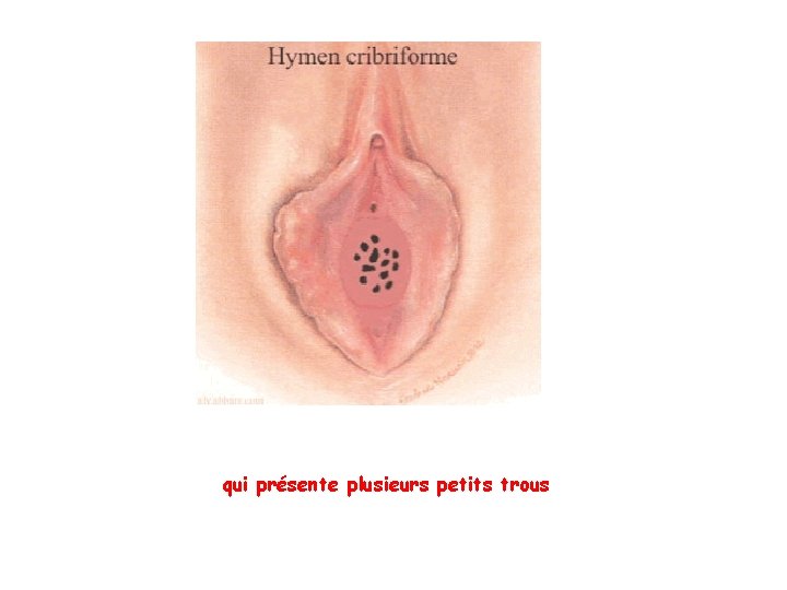 qui présente plusieurs petits trous qui présente plusieurs petits trous