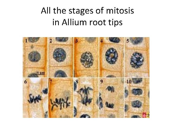 All the stages of mitosis in Allium root tips 