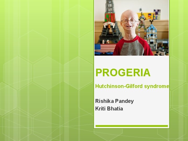 PROGERIA Hutchinson-Gilford syndrome Rishika Pandey Kriti Bhatia 