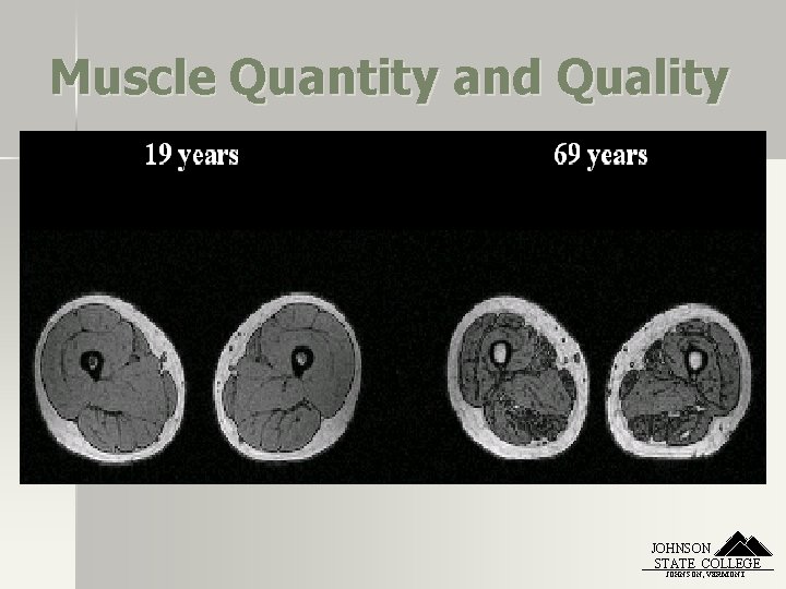 Muscle Quantity and Quality JOHNSON STATE COLLEGE JOHNSON, VERMONT 