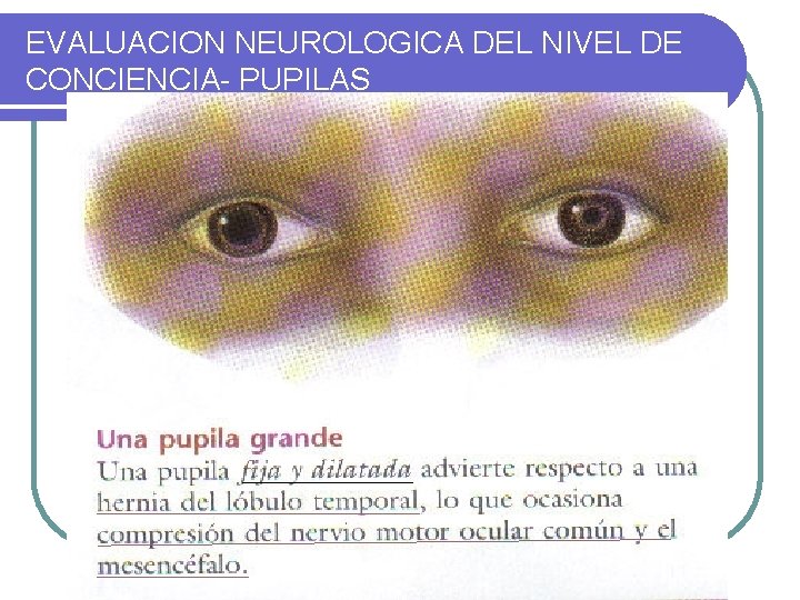 EVALUACION NEUROLOGICA DEL NIVEL DE CONCIENCIA- PUPILAS 