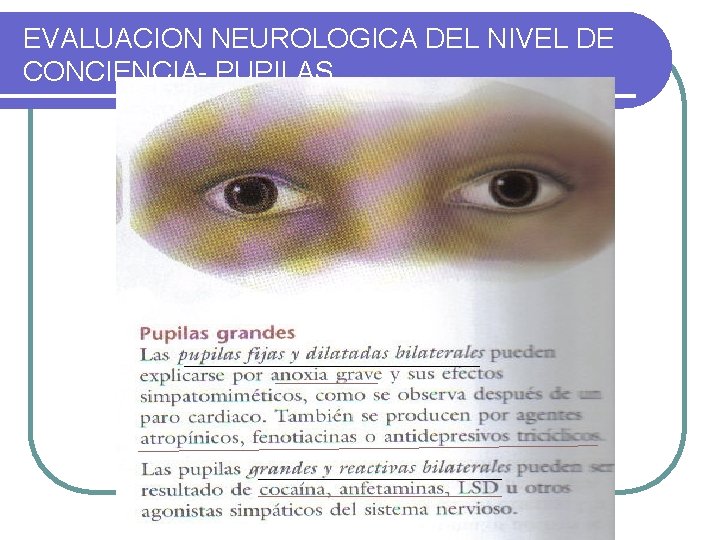 EVALUACION NEUROLOGICA DEL NIVEL DE CONCIENCIA- PUPILAS 