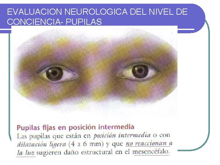 EVALUACION NEUROLOGICA DEL NIVEL DE CONCIENCIA- PUPILAS 
