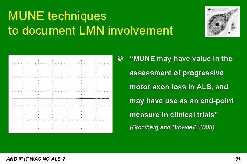 MUNE techniques to document LMN involvement ☯ “MUNE may have value in the assessment