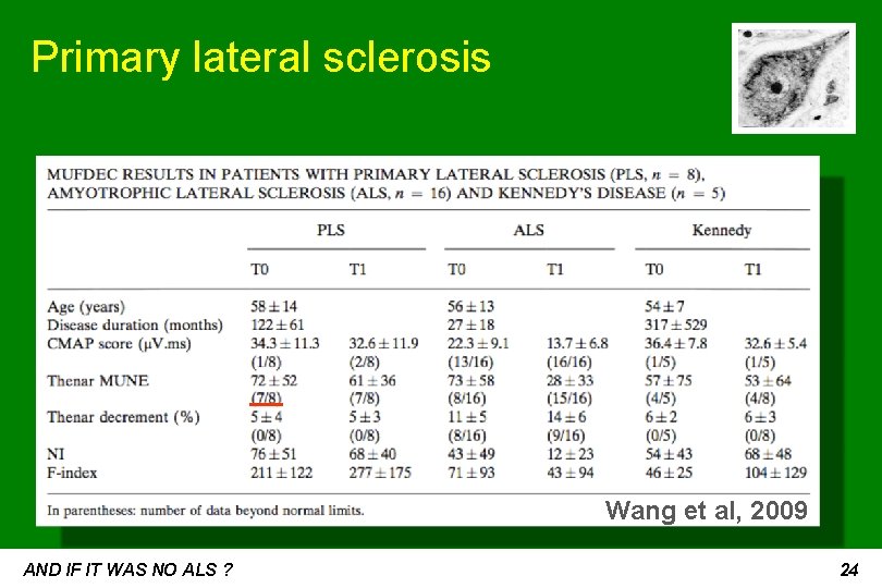 Primary lateral sclerosis Wang et al, 2009 AND IF IT WAS NO ALS ?