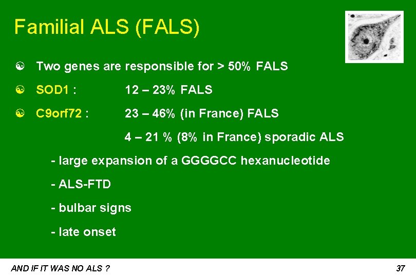 Familial ALS (FALS) ☯ Two genes are responsible for > 50% FALS ☯ SOD