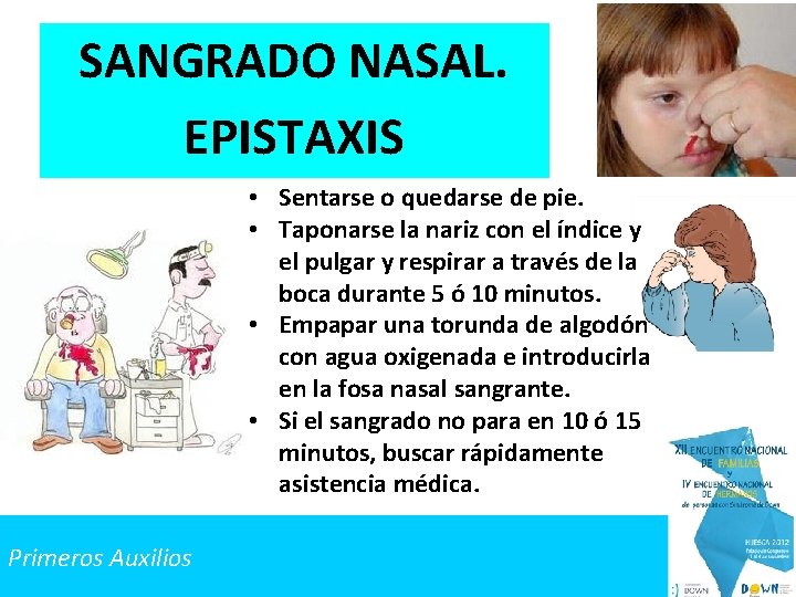 SANGRADO NASAL. EPISTAXIS • Sentarse o quedarse de pie. • Taponarse la nariz con