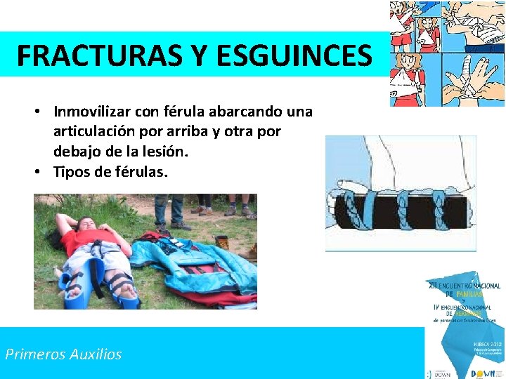 FRACTURAS Y ESGUINCES • Inmovilizar con férula abarcando una articulación por arriba y otra