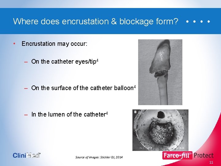 Where does encrustation & blockage form? • Encrustation may occur: – On the catheter