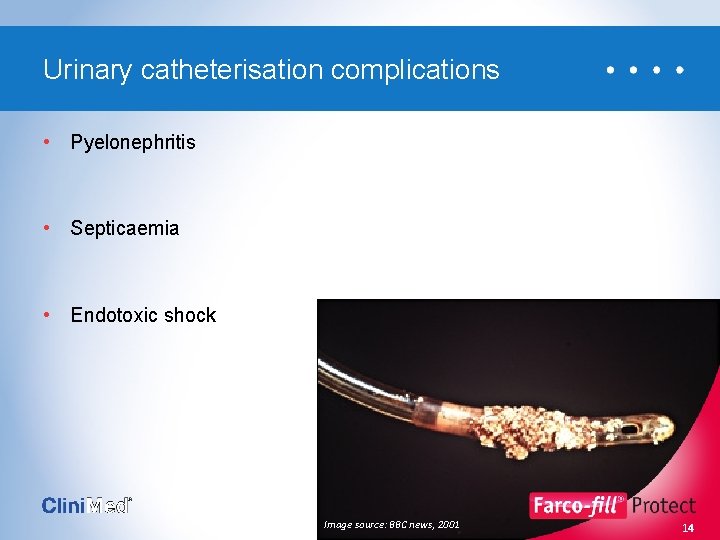 Urinary catheterisation complications • Pyelonephritis • Septicaemia • Endotoxic shock Image source: BBC news,