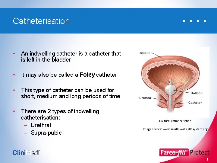 Catheterisation • An indwelling catheter is a catheter that is left in the bladder