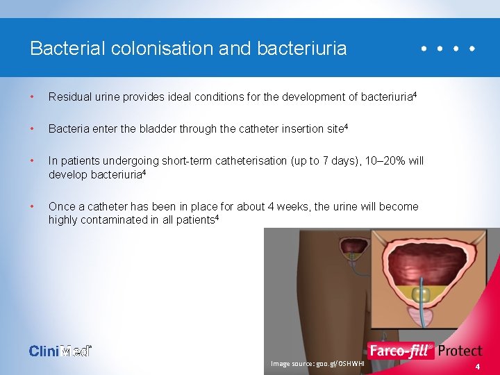 Bacterial colonisation and bacteriuria • Residual urine provides ideal conditions for the development of
