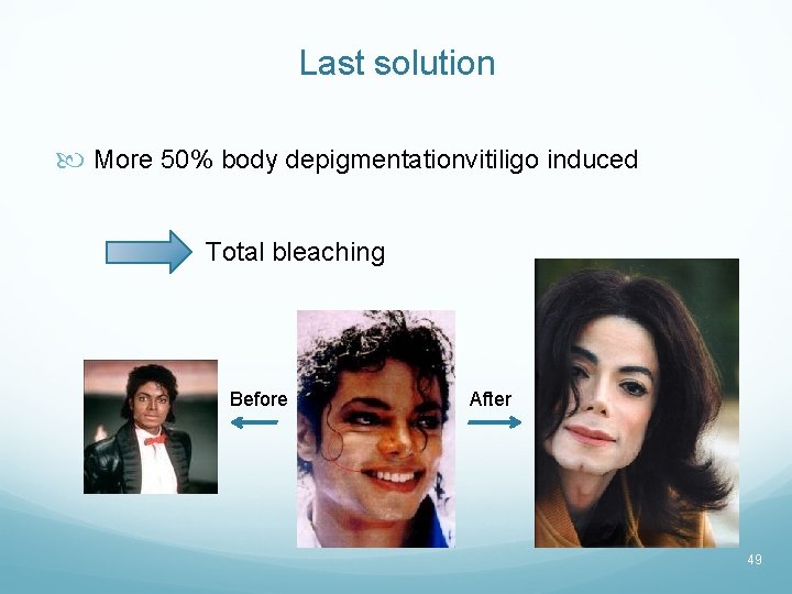 Last solution More 50% body depigmentationvitiligo induced Total bleaching Before After 49 