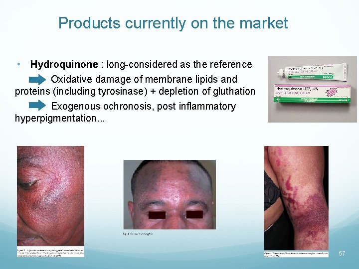 Products currently on the market • Hydroquinone : long-considered as the reference Oxidative damage