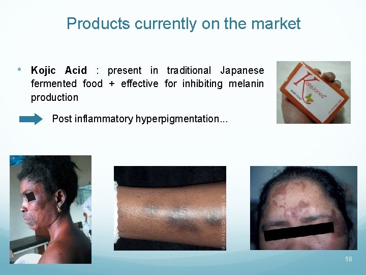 Products currently on the market • Kojic Acid : present in traditional Japanese fermented