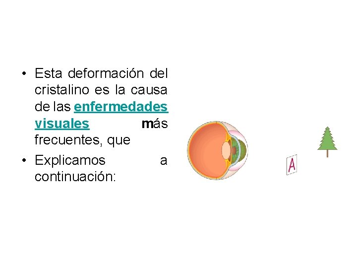  • Esta deformación del cristalino es la causa de las enfermedades visuales más