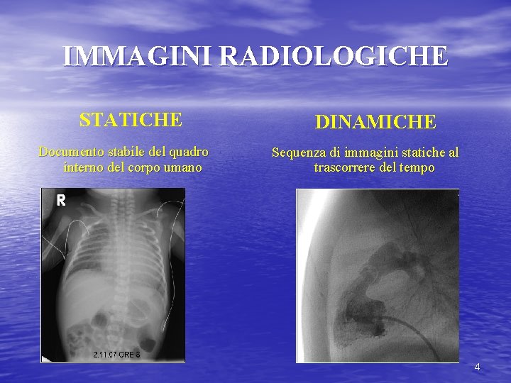 IMMAGINI RADIOLOGICHE STATICHE Documento stabile del quadro interno del corpo umano DINAMICHE Sequenza di