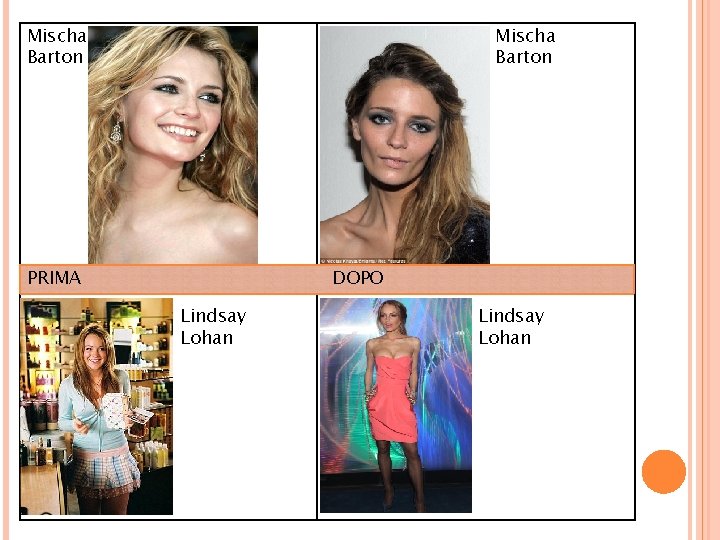 Mischa Barton PRIMA DOPO Lindsay Lohan 