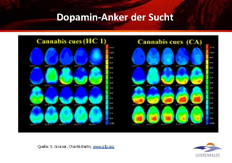Dopamin-Anker der Sucht Quelle: S. Grüsser, Charité Berlin, www. isfb. org 