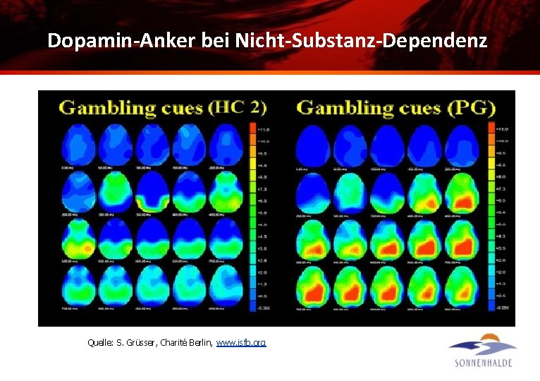 Dopamin-Anker bei Nicht-Substanz-Dependenz Quelle: S. Grüsser, Charité Berlin, www. isfb. org 
