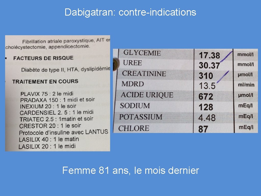 Dabigatran: contre-indications Femme 81 ans, le mois dernier 