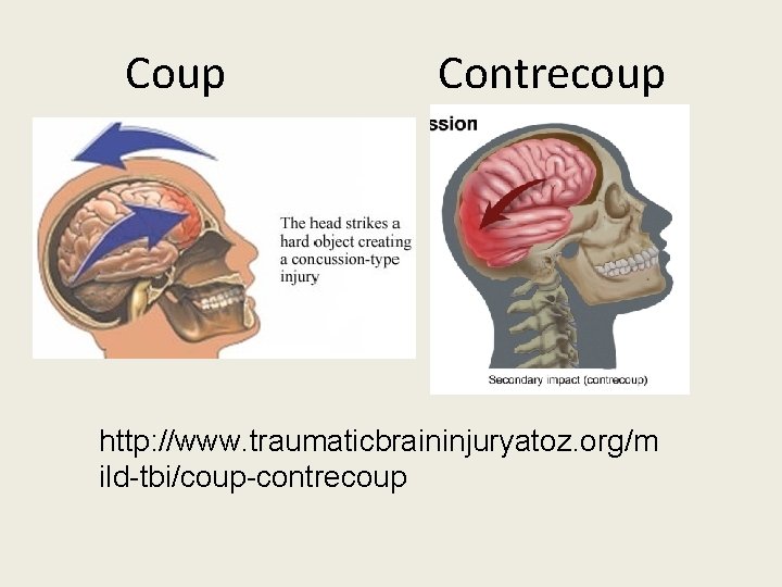 Coup Contrecoup http: //www. traumaticbraininjuryatoz. org/m ild-tbi/coup-contrecoup 