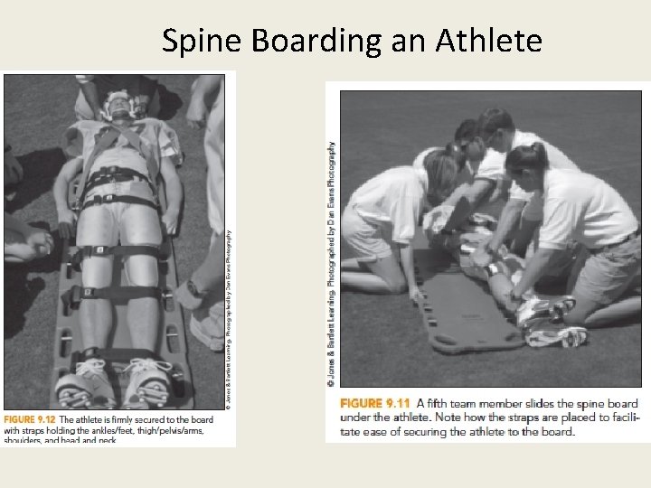 Spine Boarding an Athlete 