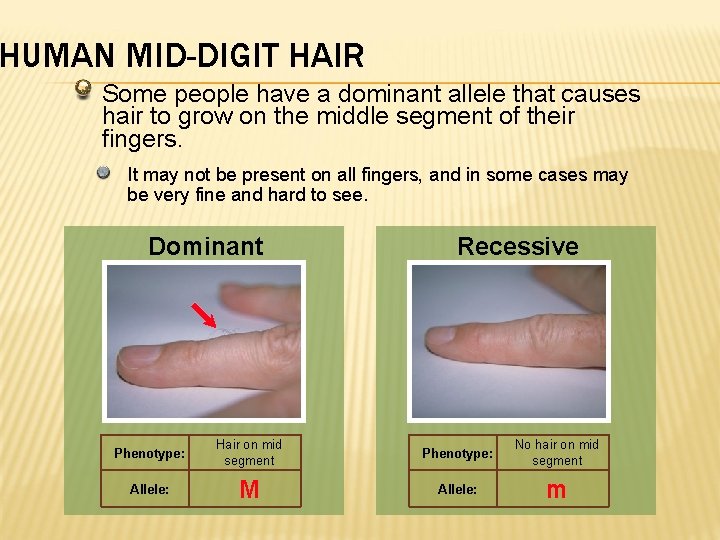 HUMAN MID-DIGIT HAIR Some people have a dominant allele that causes hair to grow