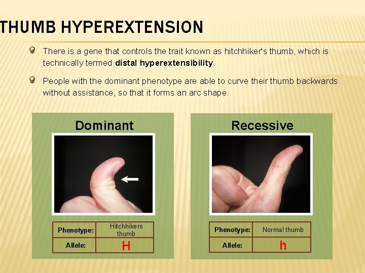 THUMB HYPEREXTENSION There is a gene that controls the trait known as hitchhiker's thumb,