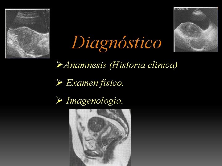 Diagnóstico ØAnamnesis (Historia clínica) Ø Examen físico. Ø Imagenología. 