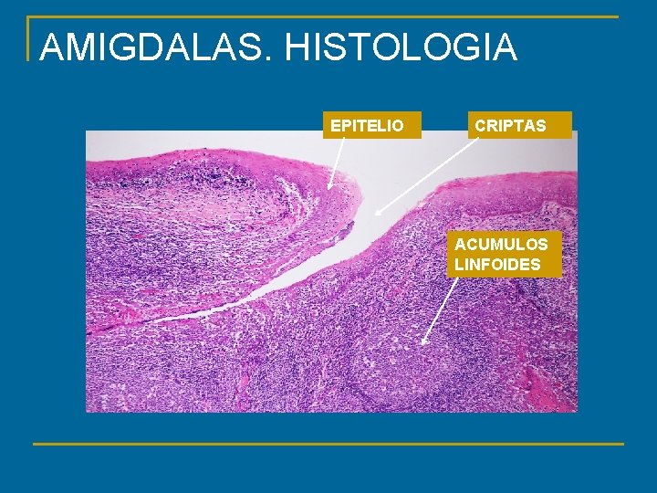 AMIGDALAS. HISTOLOGIA EPITELIO CRIPTAS ACUMULOS LINFOIDES 