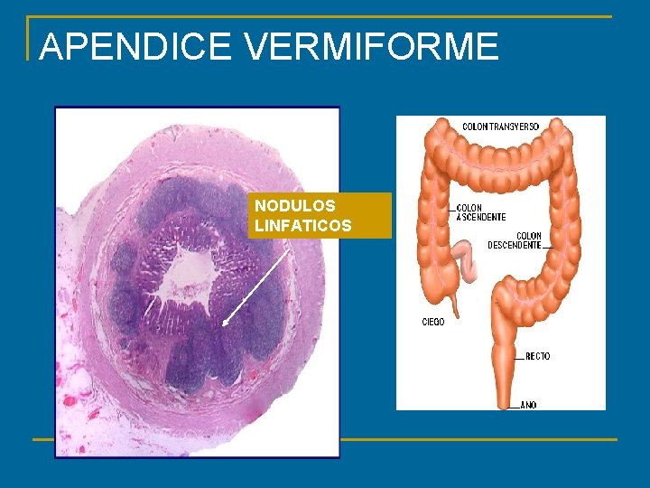 APENDICE VERMIFORME NODULOS LINFATICOS 