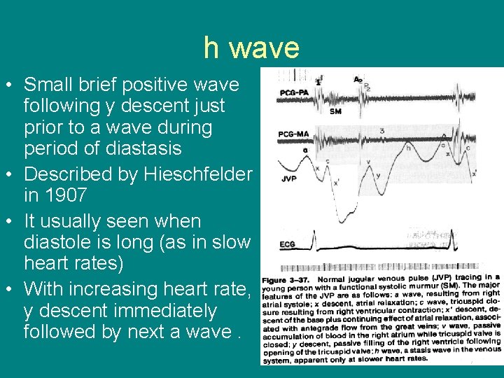 h wave • Small brief positive wave following y descent just prior to a