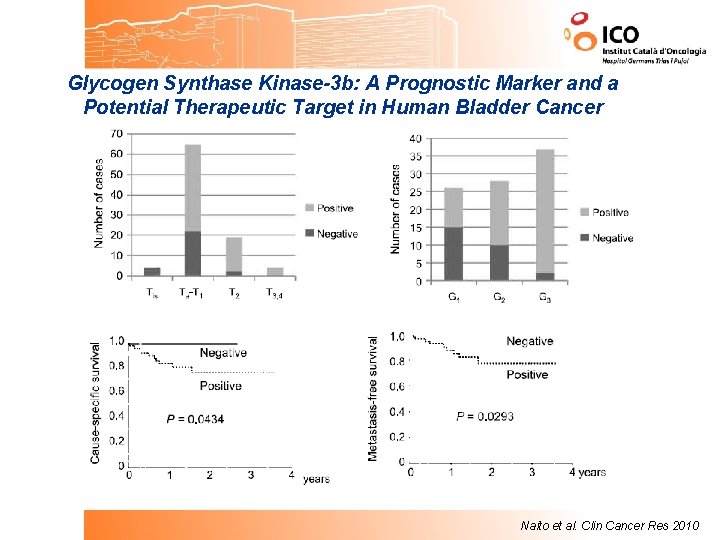 Glycogen Synthase Kinase-3 b: A Prognostic Marker and a Potential Therapeutic Target in Human