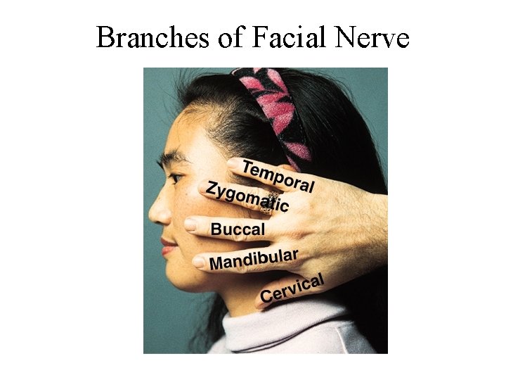 Branches of Facial Nerve 