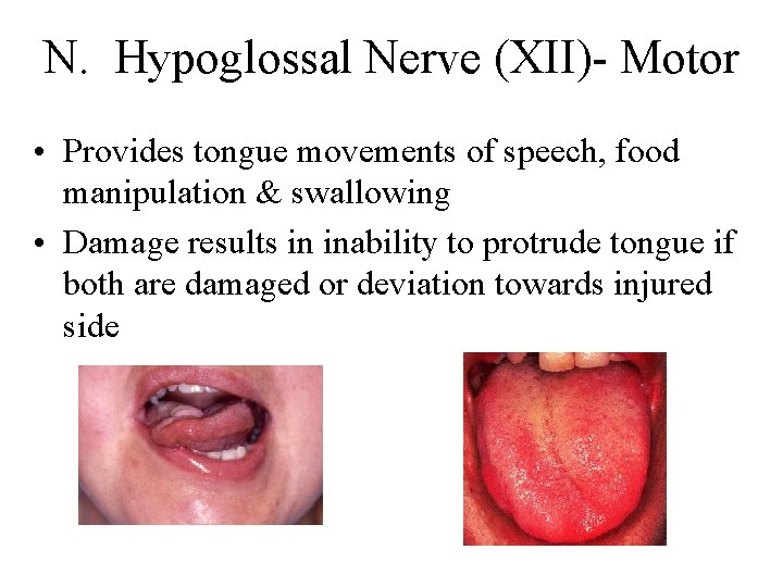 N. Hypoglossal Nerve (XII)- Motor • Provides tongue movements of speech, food manipulation &