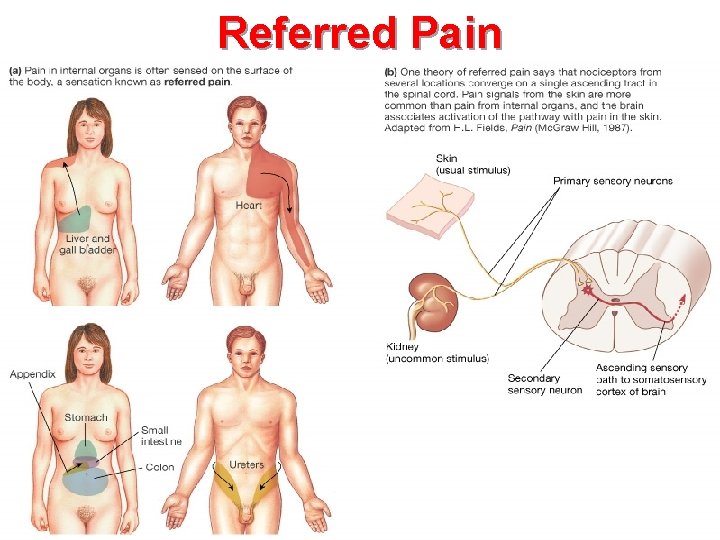 Referred Pain Figure 10 -13: Referred pain 