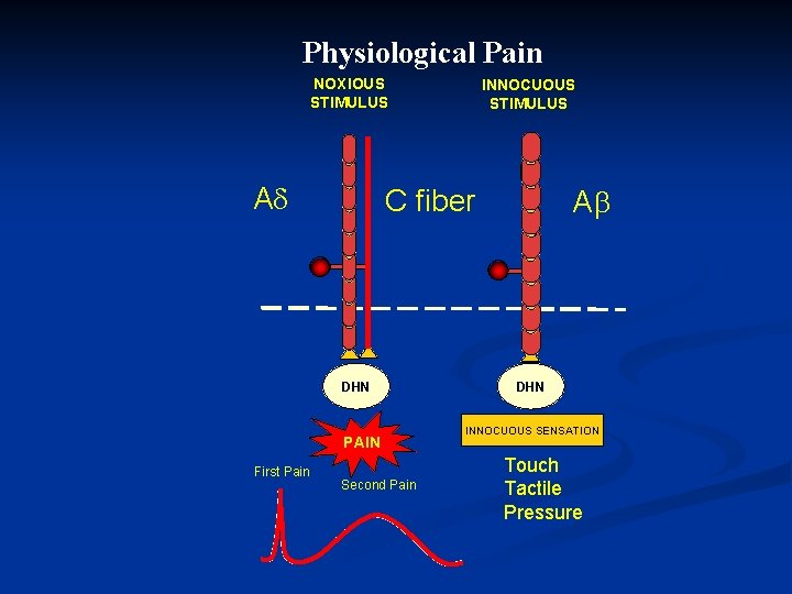 Physiological Pain NOXIOUS STIMULUS A C fiber DHN PAIN First Pain INNOCUOUS STIMULUS Second