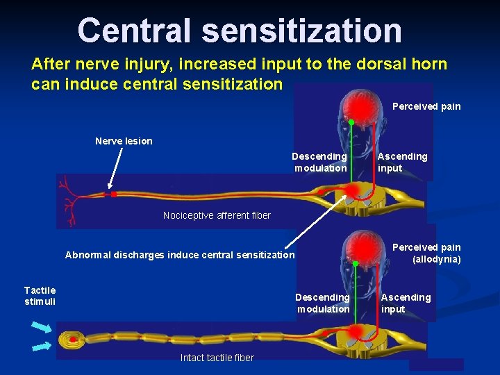 Central sensitization After nerve injury, increased input to the dorsal horn can induce central